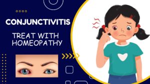 Conjunctivitis