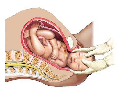 Homoeopathic Remedy for Normal Delivery – HDS