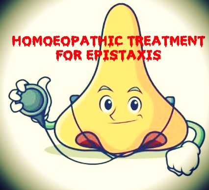 EPISTAXIS and it’s HOMOEOPATHIC THERAPEUTICS – HDS