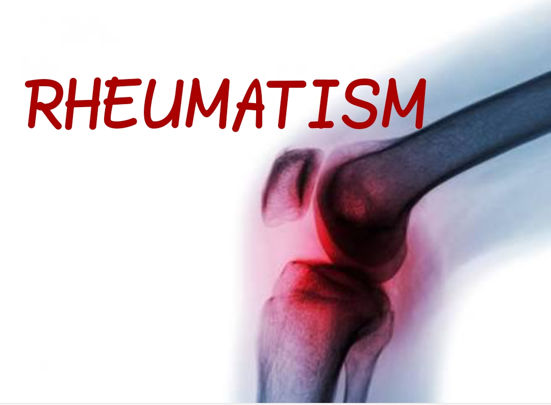 RHEUMATISM WITH HOMOEOPATHY – Homeopathic Drug Shots