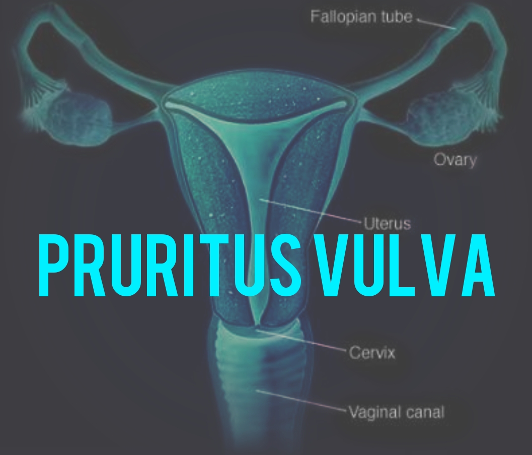 Pruritus vulva introduction with Homeopathic management | HDS