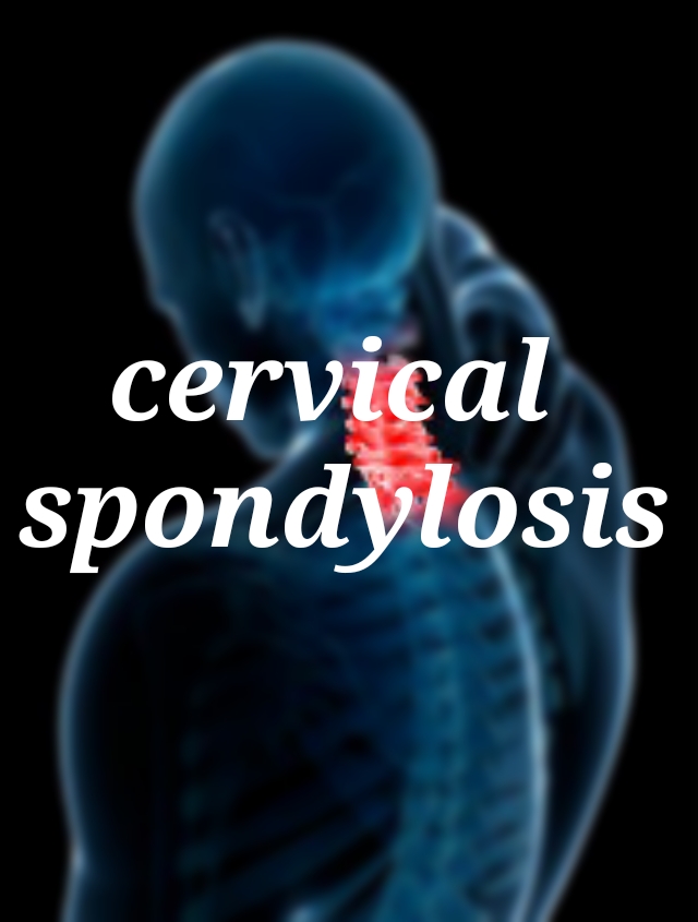 Cervical spondylosis with Homeopathy