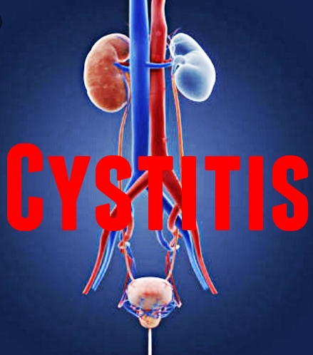 Cystitis with Homeopathy – Homoeopathic Drug Shots