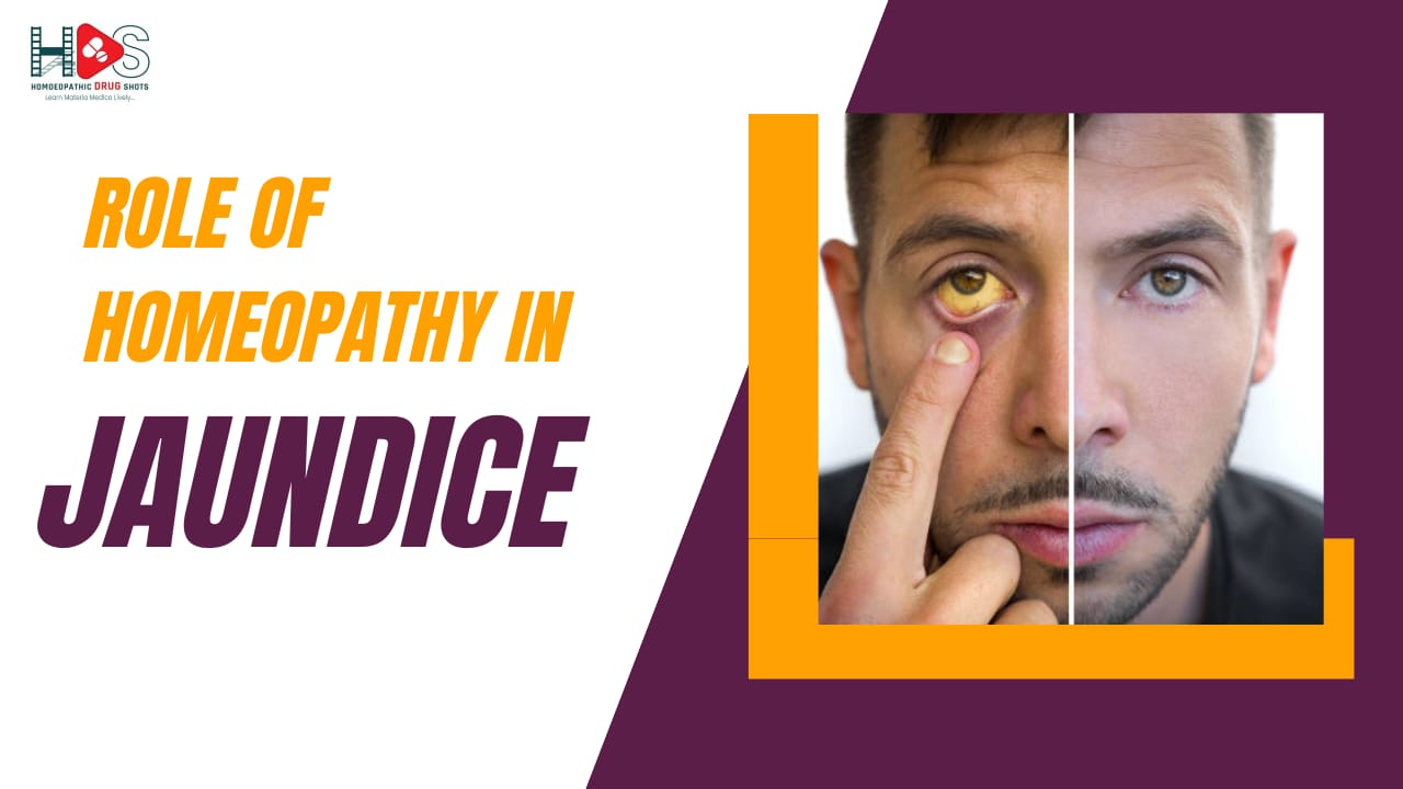 Role of Homoeopathy in Jaundice | HDS