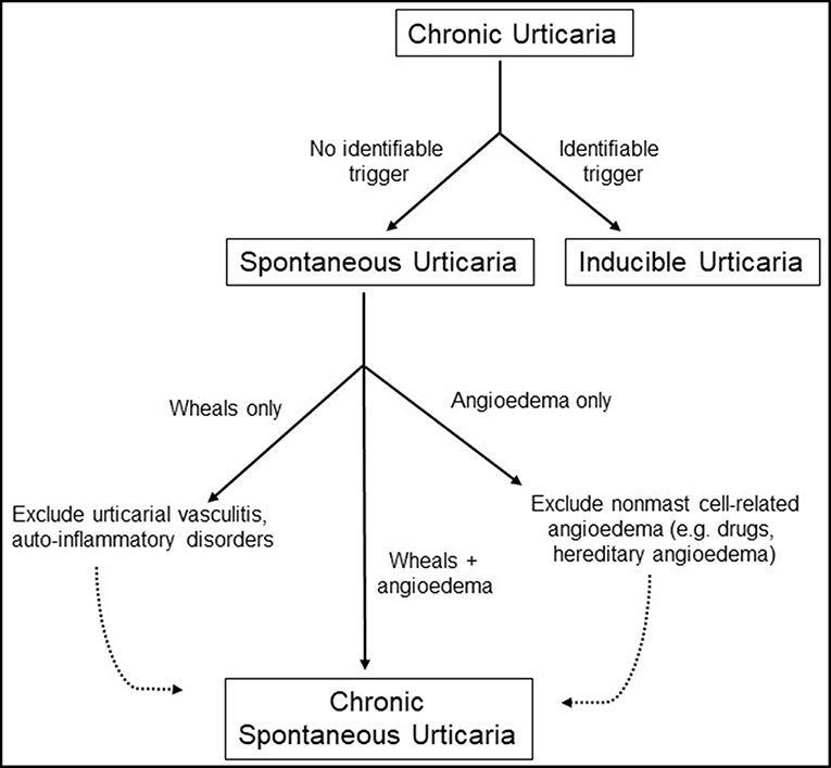 Urticarial Rash Management Urticaria and Its Homoeopathic Management | HDS